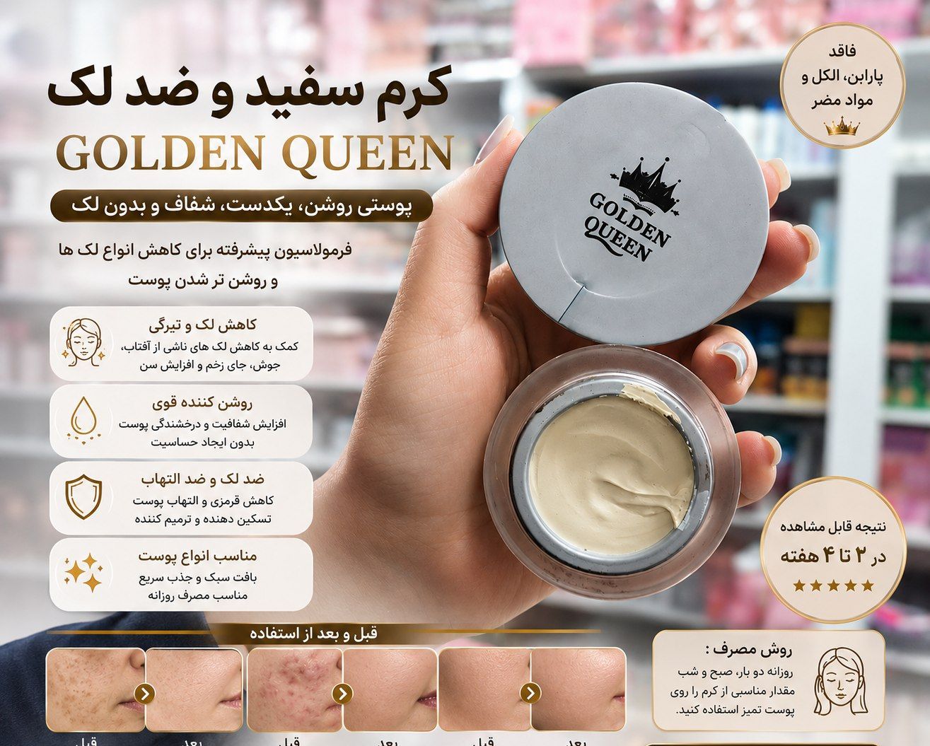 کرم ضدلک اصلی گلدن کوین